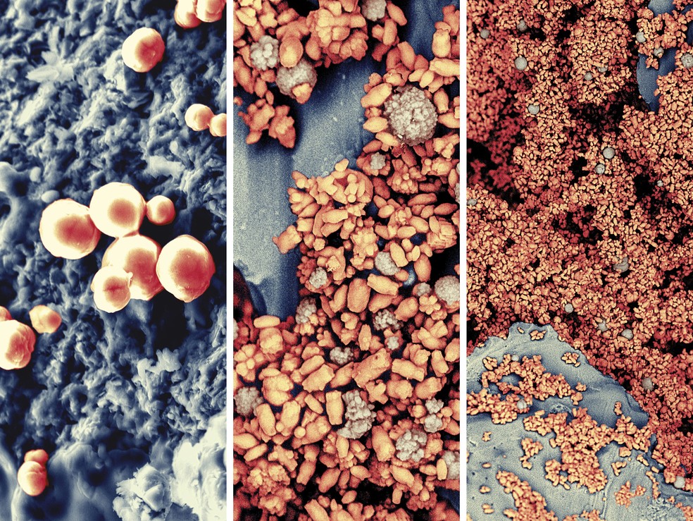 As bactérias respondem a alimentação formando cristais crescentes  — Foto: Laura Maria Gonzalez